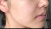 Reverse scar fade cream
