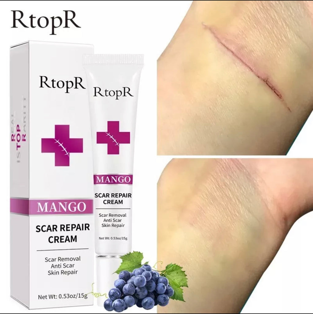 Reverse scar fade cream