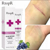 Reverse scar fade cream