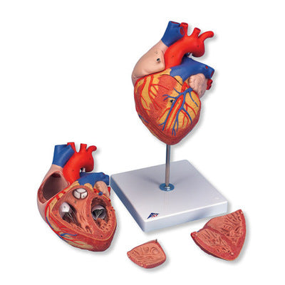 Anatomical model heart bypass surgery in 4 times the 2 part l 32*18*18cm 1.1kg