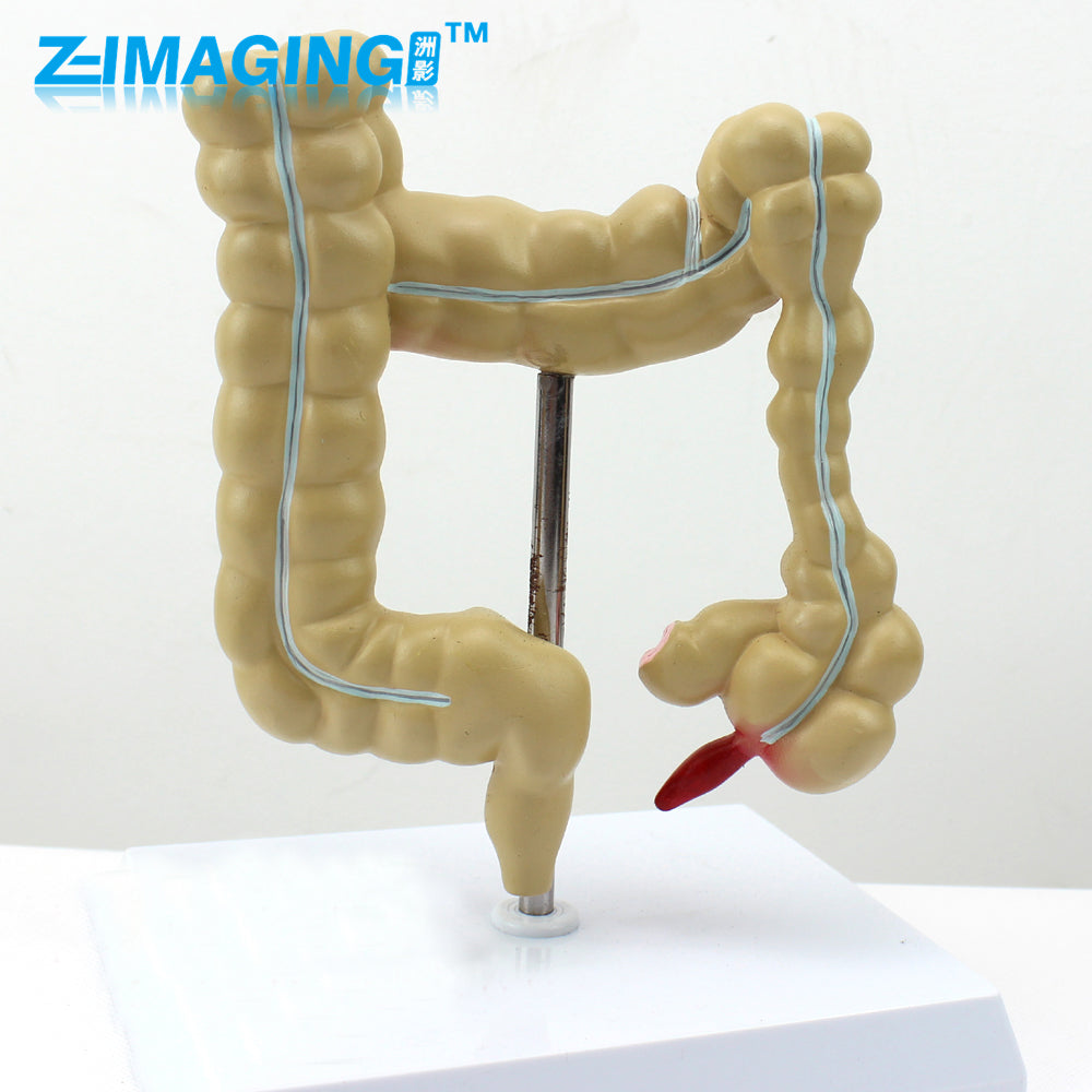 Model of human colon anorectal or collerectal disease patient education anatomical model