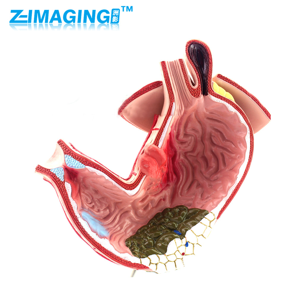 stomach model for educating patients anatomical model