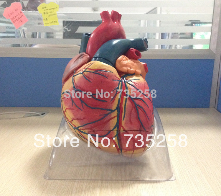 Advanced Cardiac Enlargement Model,Adult Heart Model ,Heart Anatomy Teaching Model