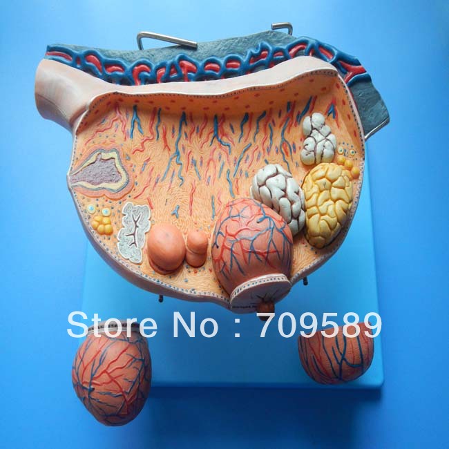 Imported PVC Human Anatomy Enlarged Ovary  Model