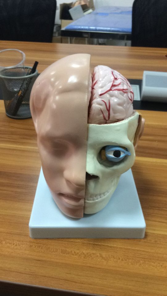 BIX-A1042 Anatomy Of The Head Cerebral Artery Model WBW299