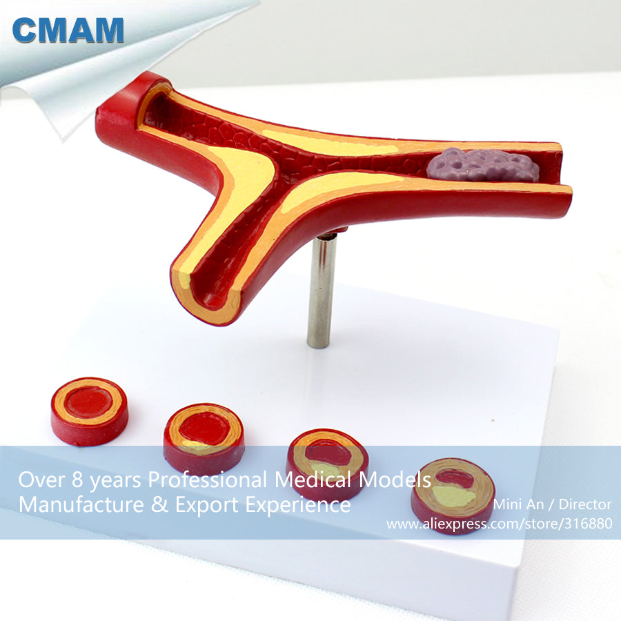 12482 CMAM-HEART06 Oversized Human Artery Anatomy Model ,  Medical Science Educational Teaching Anatomical Models
