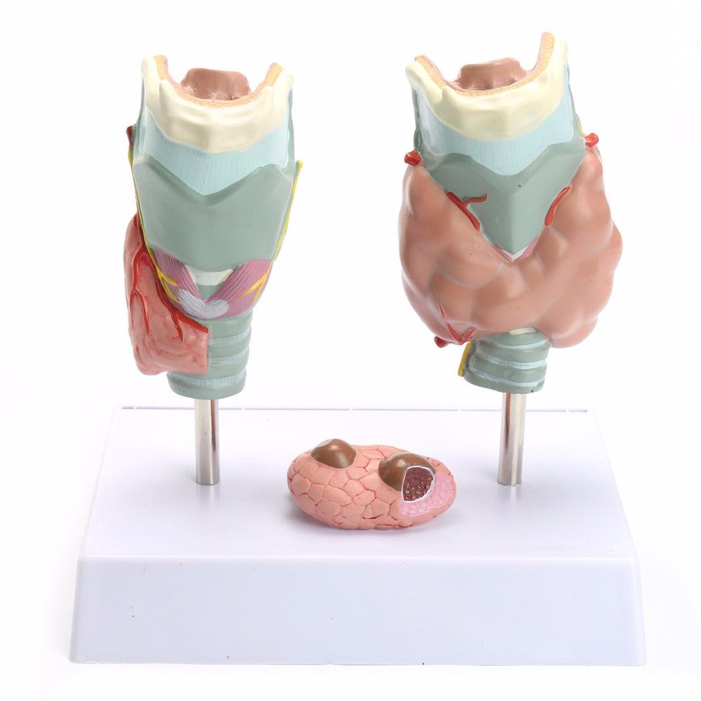 Human Anatomical Thyroid Gland Pathology Anatomy Teaching Model High Quality