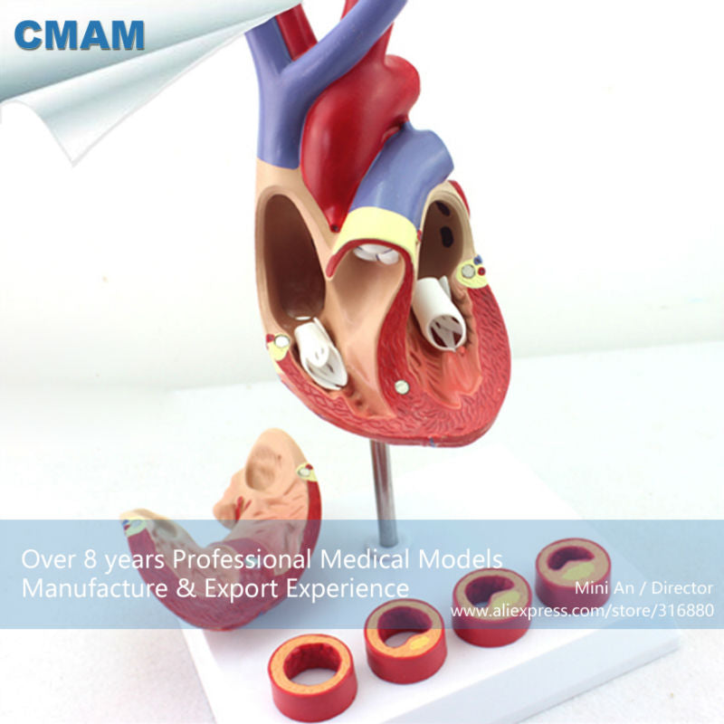 12481 CMAM-HEART05 Life-size Human Heart Anatomy in 2 part with 4 Pieces Thrombosis Cross Section ,Anatomy Models > Heart Models